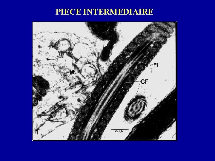 PIECE INTERMEDIAIRE 