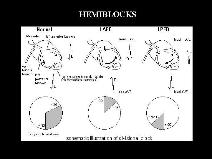  HEMIBLOCKS 