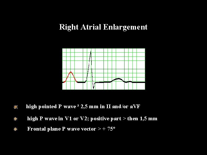 Right Atrial Enlargement high pointed P wave ³ 2, 5 mm in II and/or