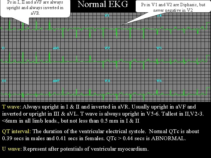 Ps in I, II and a. VF are always upright and always inverted in