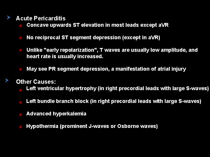 Acute Pericarditis Concave upwards ST elevation in most leads except a. VR No reciprocal