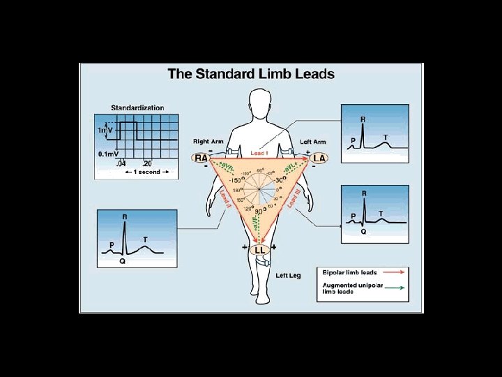 Standard Limb Leads 