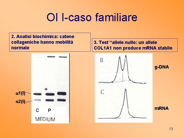 OI I-caso familiare 2. Analisi biochimica: catene collageniche hanno mobilità normale 3. Test “allele