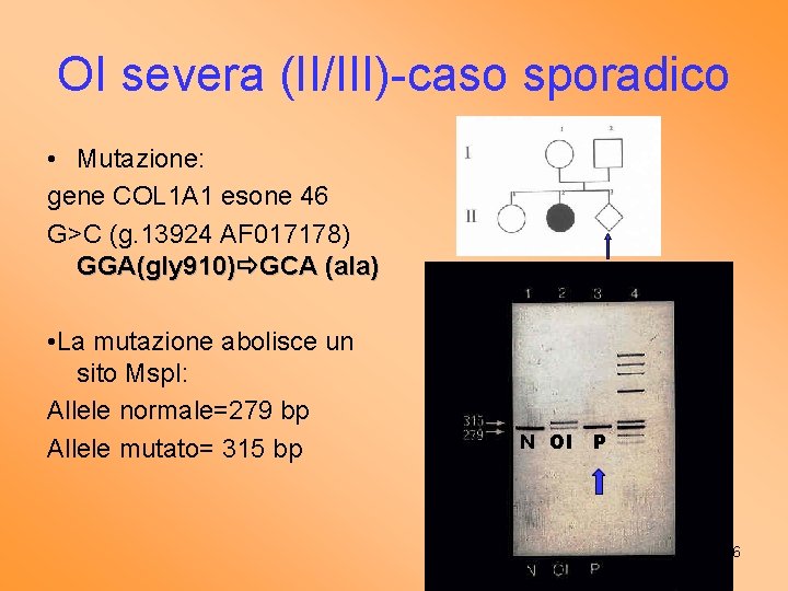 OI severa (II/III)-caso sporadico • Mutazione: gene COL 1 A 1 esone 46 G>C
