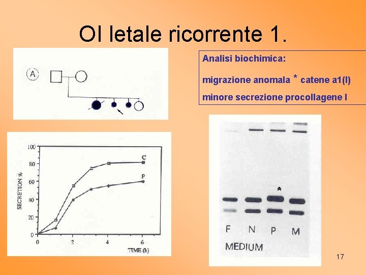 OI letale ricorrente 1. Analisi biochimica: migrazione anomala * catene a 1(I) minore secrezione