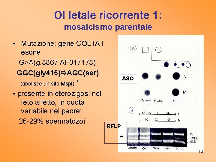 OI letale ricorrente 1: mosaicismo parentale • Mutazione: gene COL 1 A 1 esone