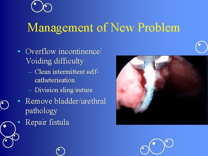 Management of New Problem • Overflow incontinence/ Voiding difficulty – Clean intermittent selfcatheterisation –