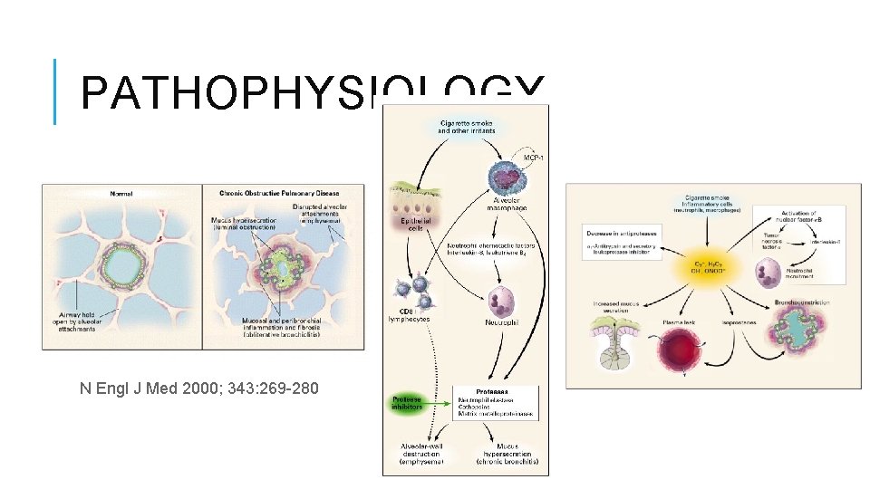 PATHOPHYSIOLOGY N Engl J Med 2000; 343: 269 -280 