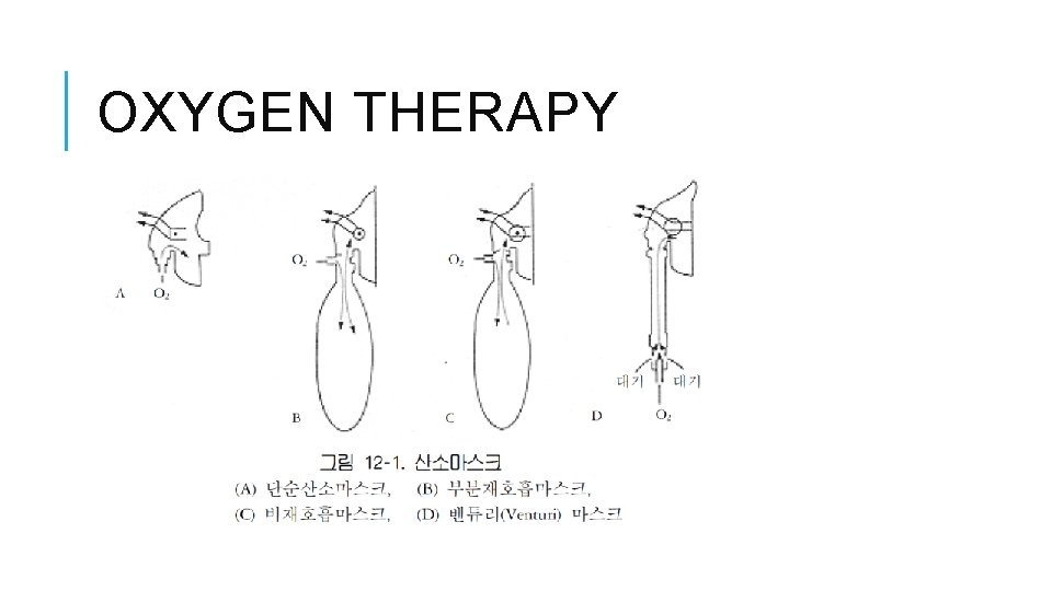 OXYGEN THERAPY 