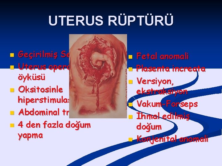 UTERUS RÜPTÜRÜ n n n Geçirilmiş Sezaryen Uterus operasyonu öyküsü Oksitosinle hiperstimulasyon Abdominal travma
