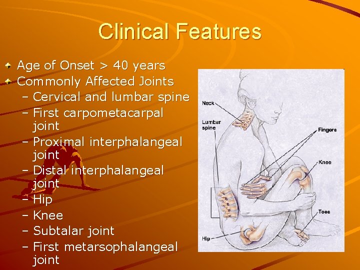 Clinical Features Age of Onset > 40 years Commonly Affected Joints – Cervical and