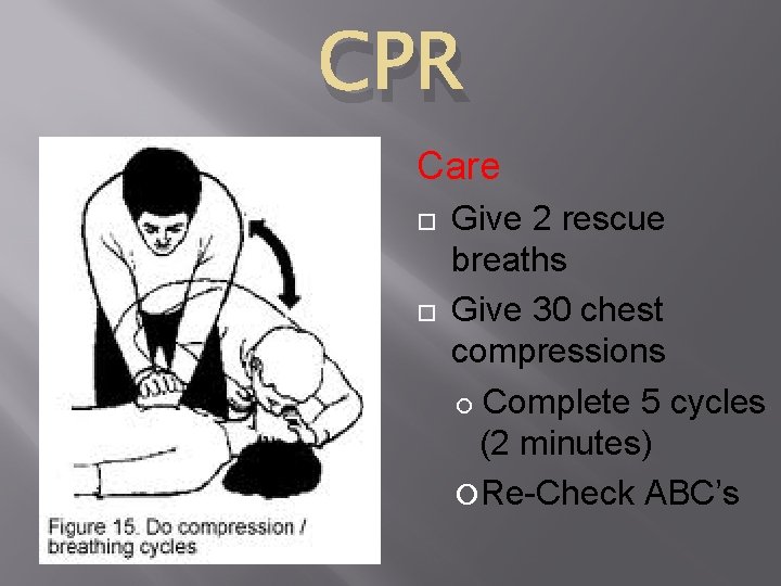 CPR Care Give 2 rescue breaths Give 30 chest compressions Complete 5 cycles (2 CPR Care Give 2 rescue breaths Give 30 chest compressions Complete 5 cycles (2
