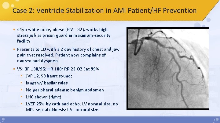 Case 2: Ventricle Stabilization in AMI Patient/HF Prevention § 44 yo white male, obese