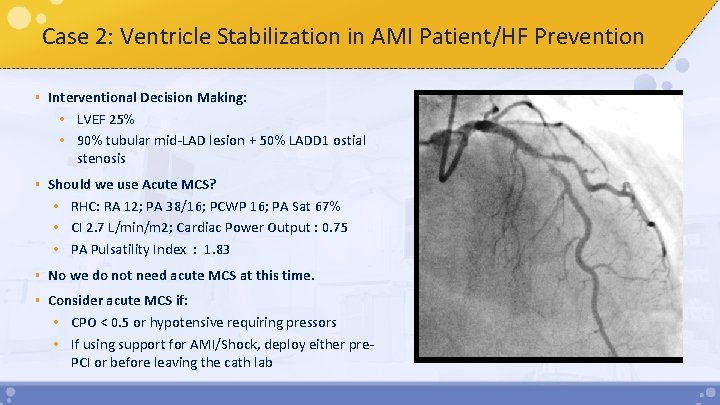 Case 2: Ventricle Stabilization in AMI Patient/HF Prevention § Interventional Decision Making: • LVEF