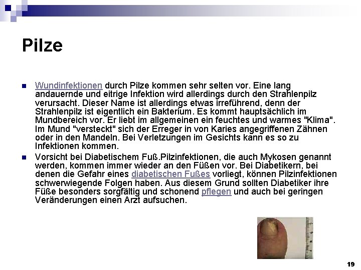 Pilze n n Wundinfektionen durch Pilze kommen sehr selten vor. Eine lang andauernde und