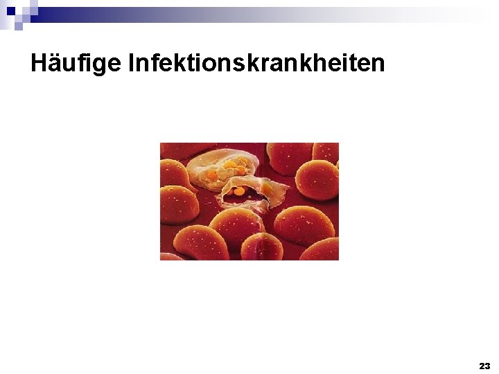 Häufige Infektionskrankheiten 23 