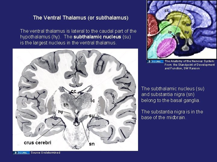cc The Ventral Thalamus (or subthalamus) th The ventral thalamus is lateral to the cc The Ventral Thalamus (or subthalamus) th The ventral thalamus is lateral to the