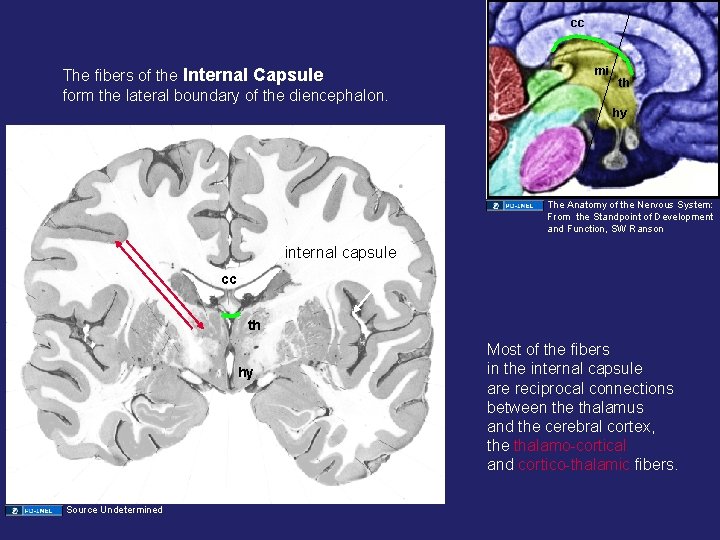 cc The fibers of the Internal Capsule form the lateral boundary of the diencephalon. cc The fibers of the Internal Capsule form the lateral boundary of the diencephalon.