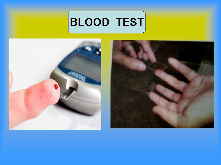 BLOOD TEST 