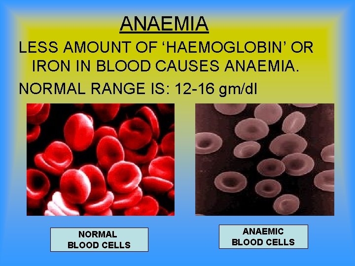ANAEMIA LESS AMOUNT OF ‘HAEMOGLOBIN’ OR IRON IN BLOOD CAUSES ANAEMIA. NORMAL RANGE IS: