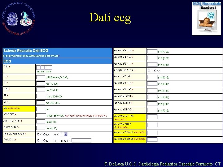 Dati ecg F. De Luca U. O. C. Cardiologia Pediatrica Ospedale Ferrarotto CT 