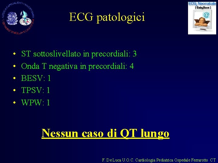 ECG patologici • • • ST sottoslivellato in precordiali: 3 Onda T negativa in