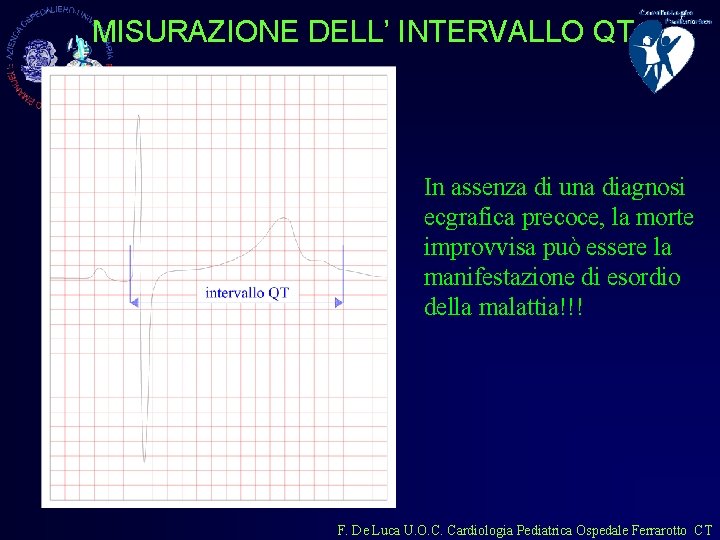 MISURAZIONE DELL’ INTERVALLO QT In assenza di una diagnosi ecgrafica precoce, la morte improvvisa