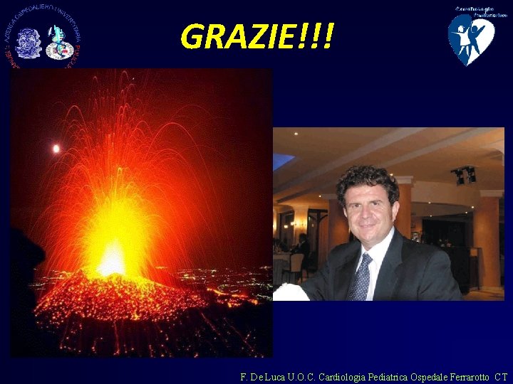 GRAZIE!!! F. De Luca U. O. C. Cardiologia Pediatrica Ospedale Ferrarotto CT 