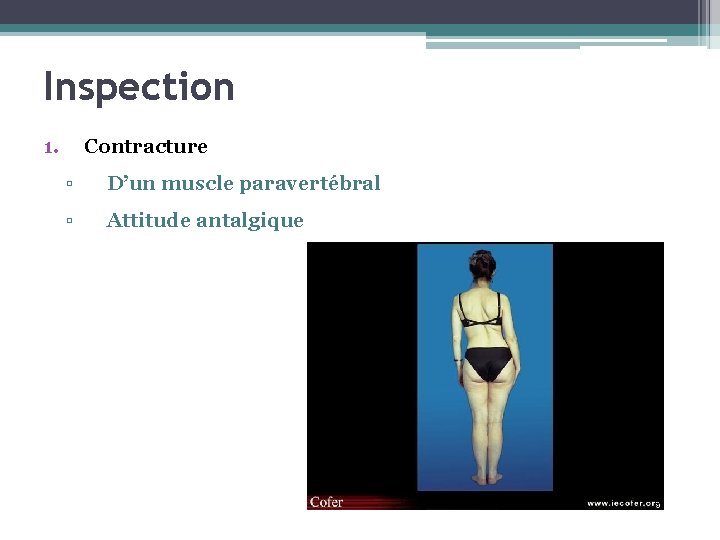 Inspection 1. Contracture ▫ D’un muscle paravertébral ▫ Attitude antalgique 