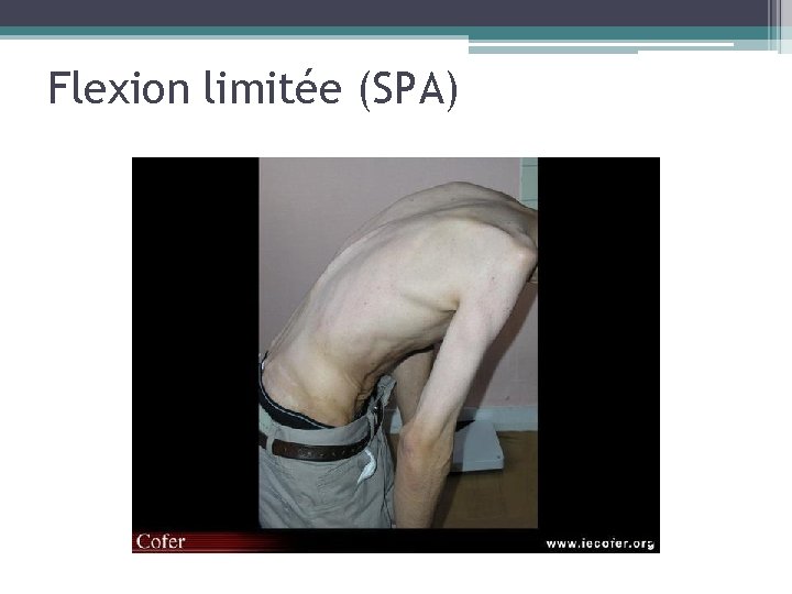 Flexion limitée (SPA) 