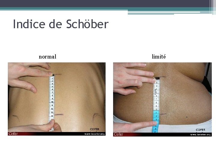 Indice de Schöber normal limité 
