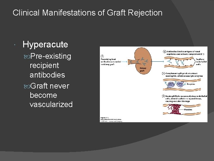 Clinical Manifestations of Graft Rejection Hyperacute Pre-existing recipient antibodies Graft never become vascularized 