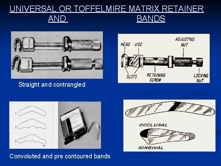 UNIVERSAL OR TOFFELMIRE MATRIX RETAINER AND BANDS Straight and contrangled Convoluted and pre contoured