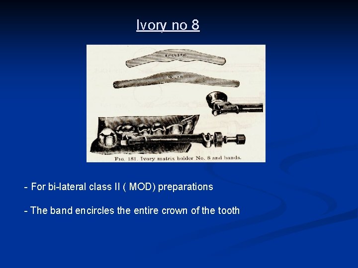 Ivory no 8 - For bi-lateral class II ( MOD) preparations - The band