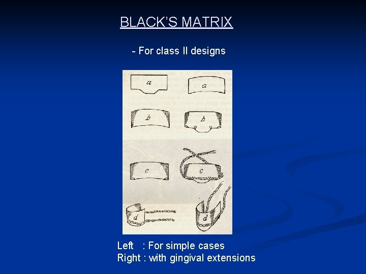 BLACK’S MATRIX - For class II designs Left : For simple cases Right :