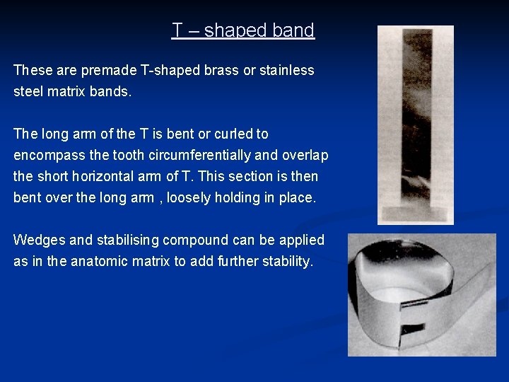 T – shaped band These are premade T-shaped brass or stainless steel matrix bands.