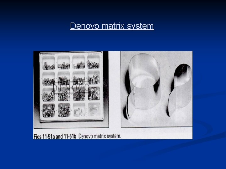 Denovo matrix system 