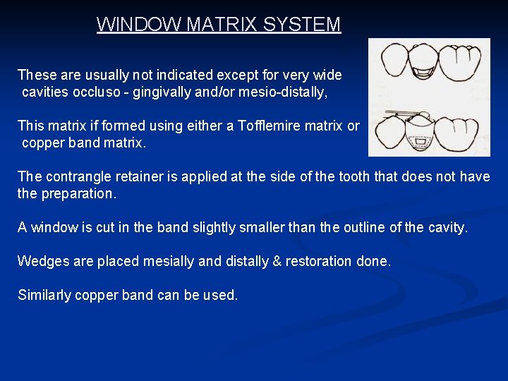 WINDOW MATRIX SYSTEM These are usually not indicated except for very wide cavities occluso