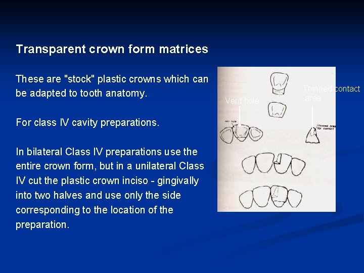 Transparent crown form matrices These are "stock" plastic crowns which can be adapted to