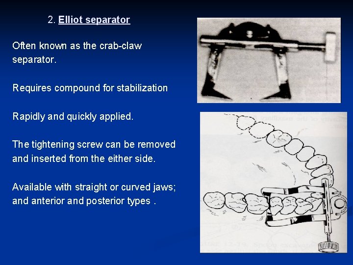 2. Elliot separator Often known as the crab-claw separator. Requires compound for stabilization Rapidly