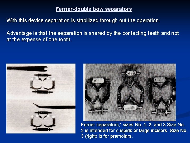 Ferrier-double bow separators With this device separation is stabilized through out the operation. Advantage
