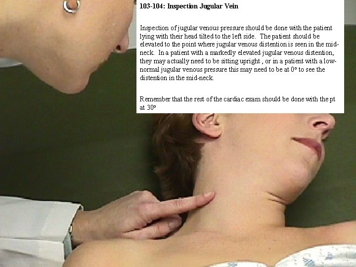 103 -104: Inspection Jugular Vein Inspection of jugular venous pressure should be done with