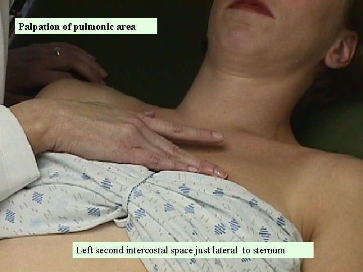Palpation of pulmonic area Left second intercostal space just lateral to sternum 