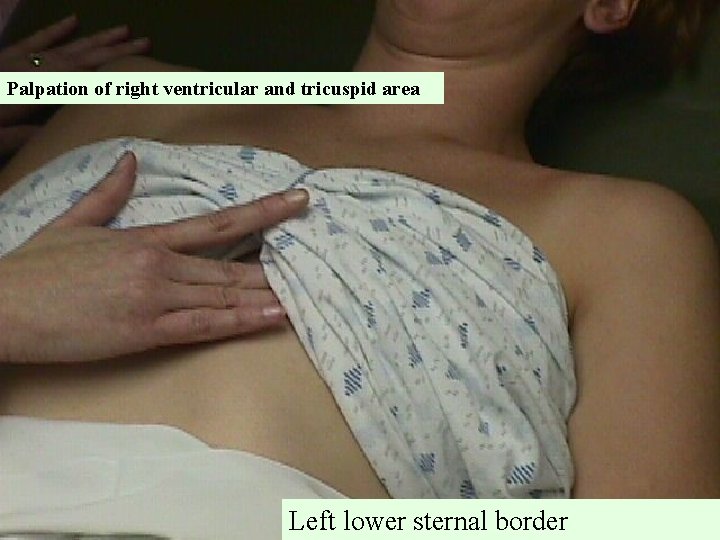 Palpation of right ventricular and tricuspid area Left lower sternal border 