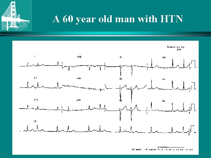 A 60 year old man with HTN © Continuing Medical Implementation …. . .