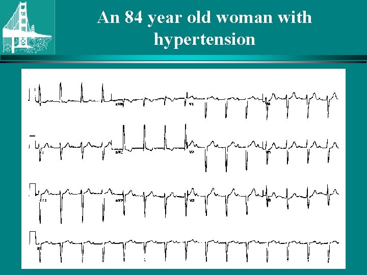 An 84 year old woman with hypertension © Continuing Medical Implementation …. . .