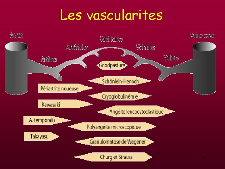 Les vascularites 15 Les vascularites 15