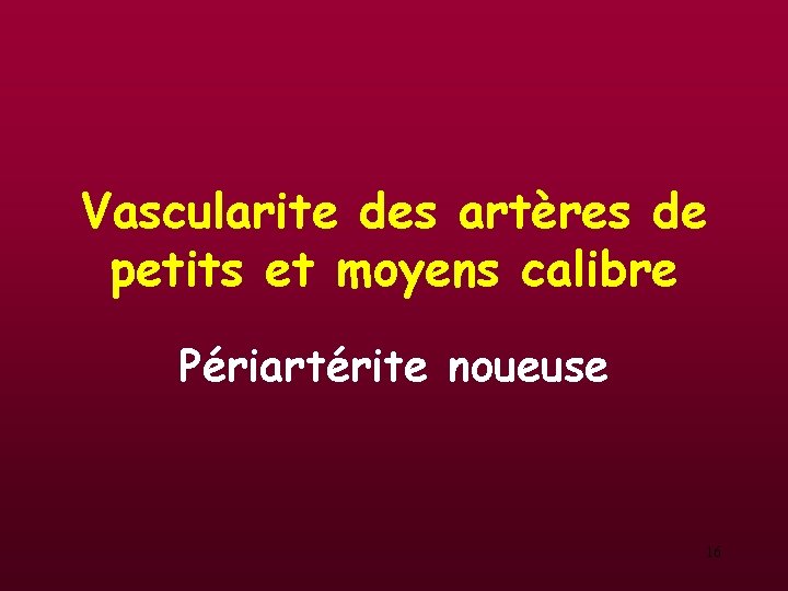 Vascularite des artères de petits et moyens calibre Périartérite noueuse 16 Vascularite des artères de petits et moyens calibre Périartérite noueuse 16