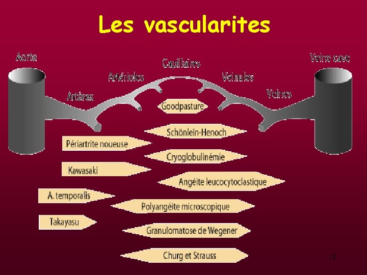 Les vascularites 18 Les vascularites 18