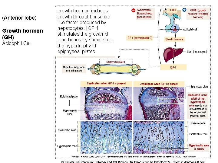 (Anterior lobe) Growth hormon (GH) Acidophil Cell growth hormon induces growth throught insuline like